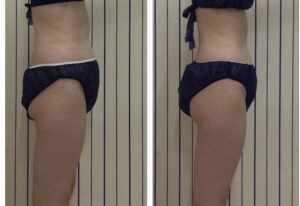 左がbefore
右がafter